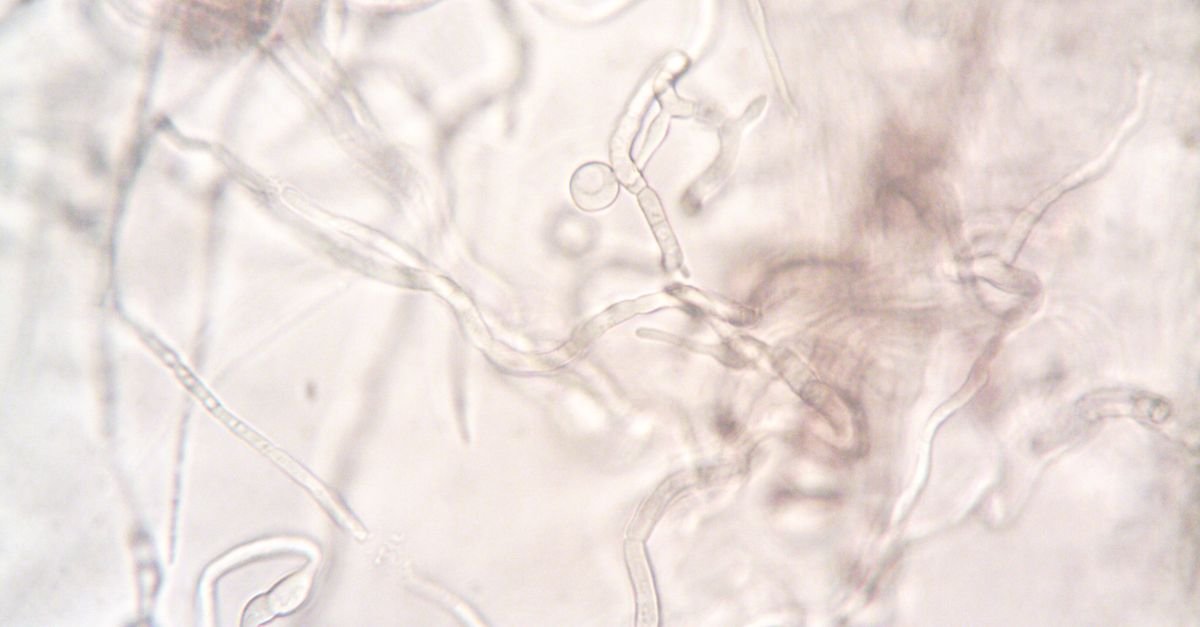 Magnified view of branching fungal hyphae, the living body behind a black stain on a wall
